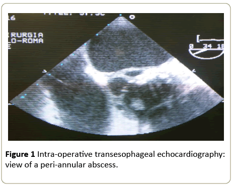 interventional-cardiology-Intra-operative