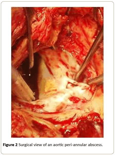 interventional-cardiology-Surgical-view