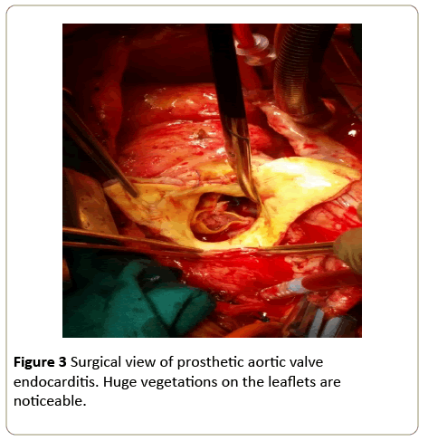 interventional-cardiology-Surgical-view