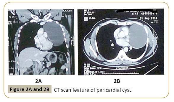 interventional-cardiology-CT-scan